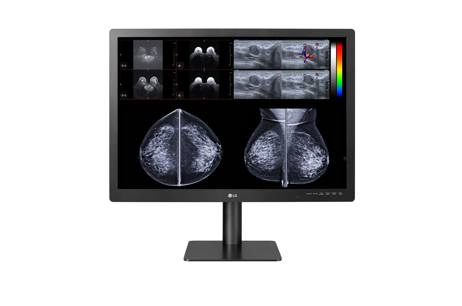 LG 31HN713D 31" MAMMOGRAPHY 4200X2800 IPS HAS DP/USB