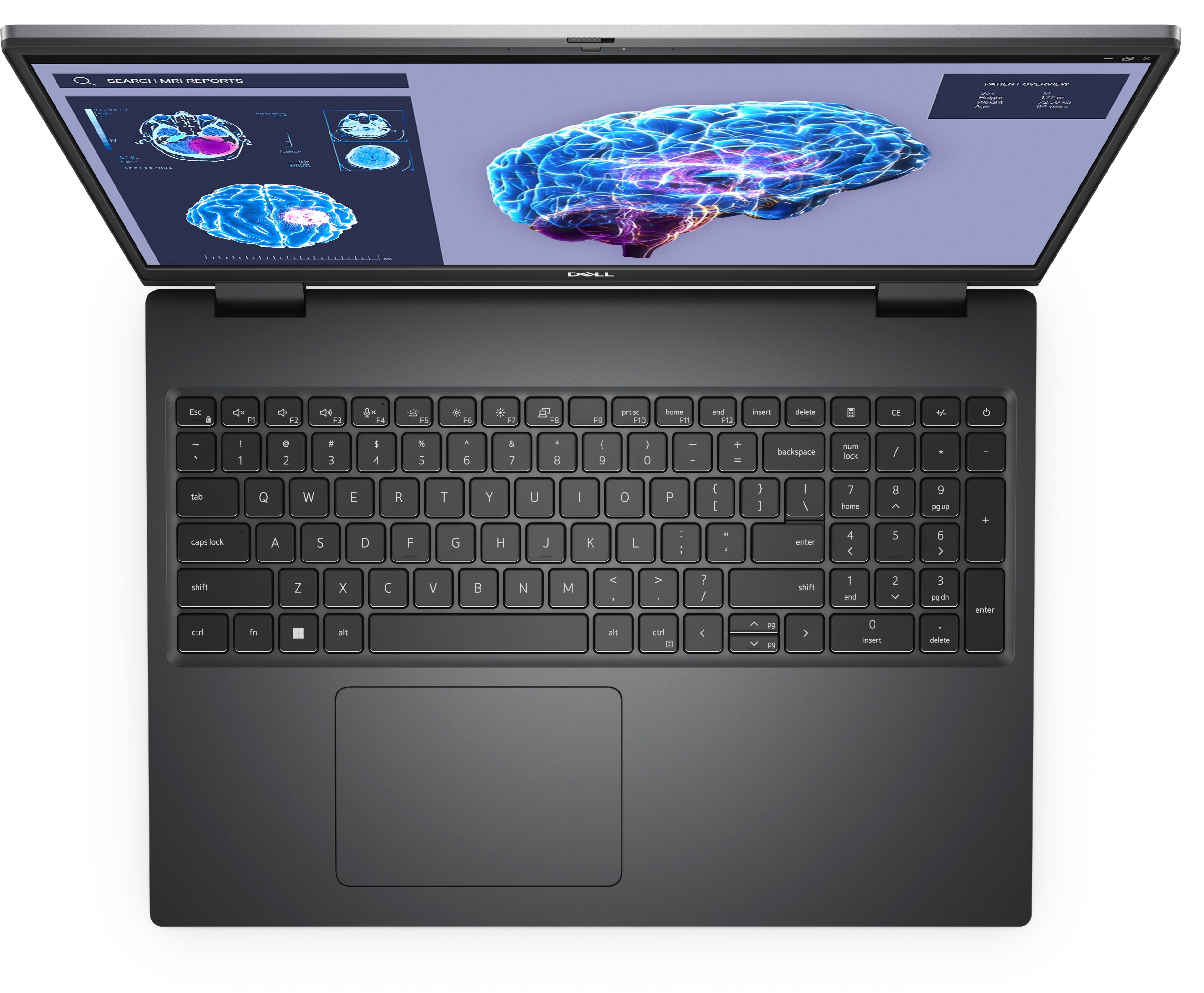 DELL PM7680 I7-13850HX/16FHD+/32GB/1TBSSD/RTX2000ADA/11P/3PS